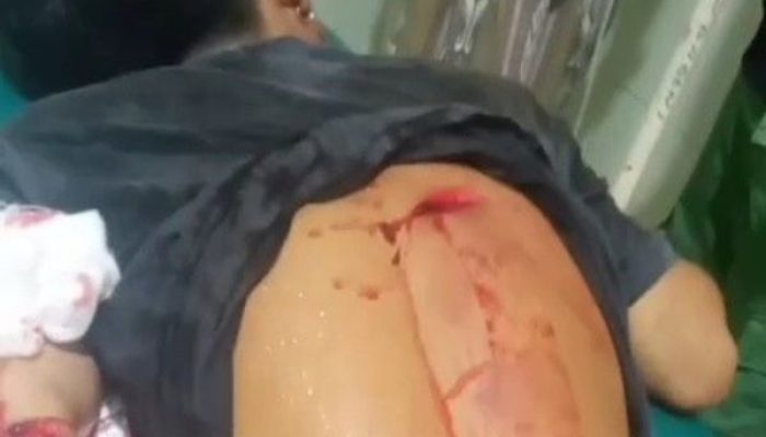 Pelaku Pembacokan di Alun-Alun Arjasa Belum Tertangkap, Bidik Soroti Polsek Kangean